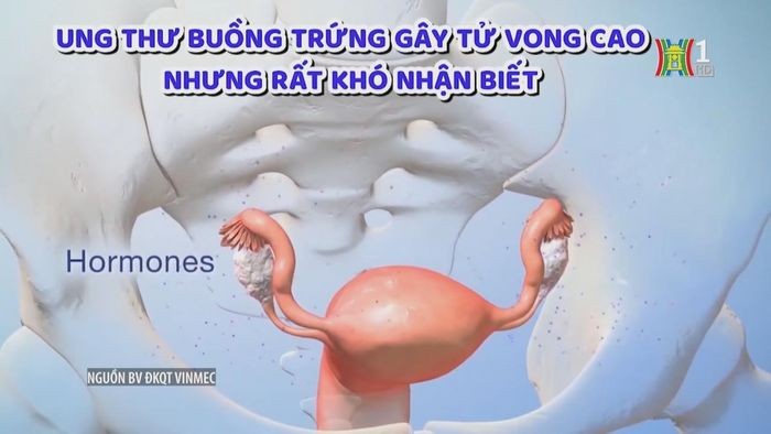 Việt Nam chế tạo Kit ELISA chẩn đoán bệnh ung thư buồng trứng