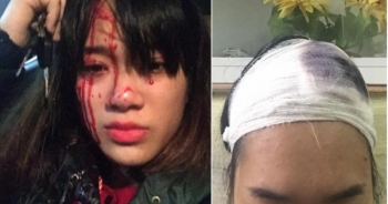 Hà Nội: Xôn xao hình ảnh cô gái bị hai nam thanh niên trêu ghẹo, đánh vỡ đầu