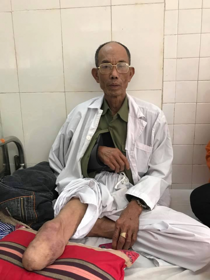 &Ocirc;ng Vin đang được điều trị tại Bệnh Viện 103 (ảnh Nguyễn Văn Duẩn).
