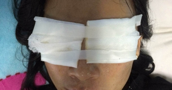 Quảng Bình: Mẹ chồng tạt a xít vào mặt nàng dâu vì mâu thuẫn
