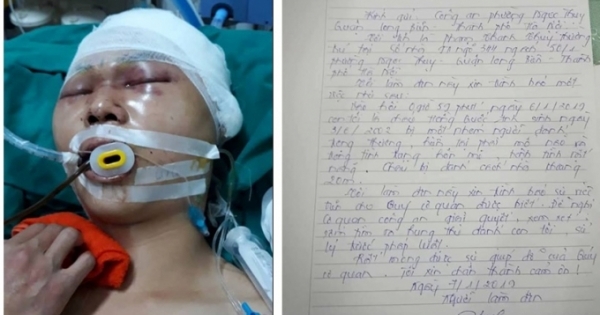 Hà Nội: Một học sinh bị đánh tập thể phải nhập viện mổ não
