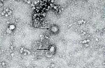Chuyên gia Australia nuôi cấy thành công chủng coronavirus mới