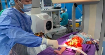 Quảng Ninh: Bệnh viện Sản nhi can thiệp kịp thời cho 3 bệnh nhân nhi bị tim bẩm sinh