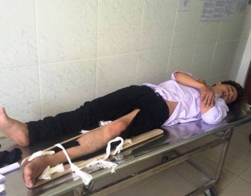 Đối tượng B&ugrave;i Thanh Ẩn đang điều trị tại bệnh viện.