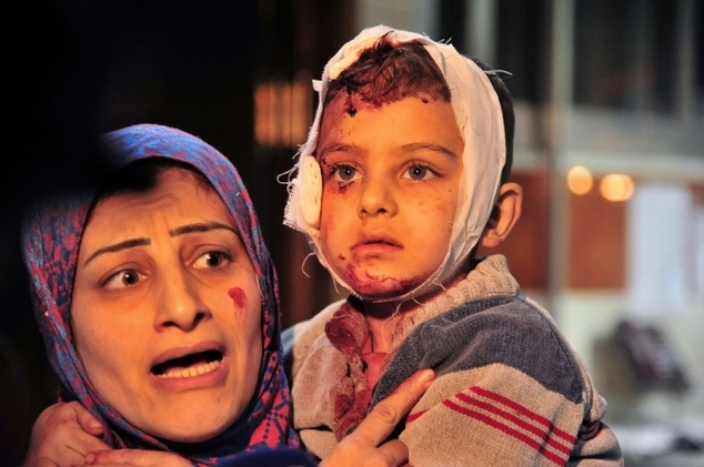 Rất nhiều trẻ em đ&atilde; bị thương trong vụ tấn c&ocirc;ng khủng bố tại Syria. (Ảnh: AFP)