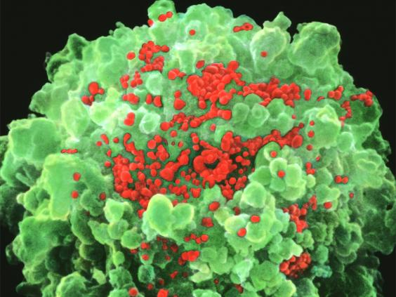 H&igrave;nh ảnh hiển vi của virus HIV. (Ảnh: Independent).