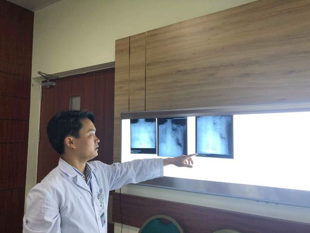 BS Thạch cho biết, phim chụp X-quang phổi cho thấy bệnh nh&acirc;n vi&ecirc;m phổi rất trầm trọng. Ảnh: H.Hải