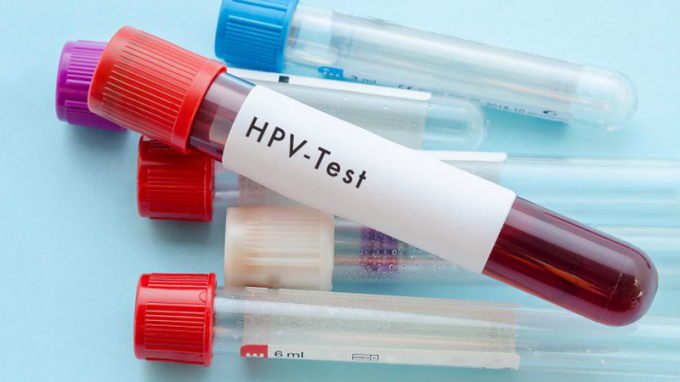 Virus HPV l&agrave; một trong những nguy&ecirc;n nh&acirc;n g&acirc;y ung thư cổ tử cung.&nbsp;