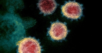 Các nhà khoa học Mỹ đã hoàn thành chế tạo vắc-xin virus corona