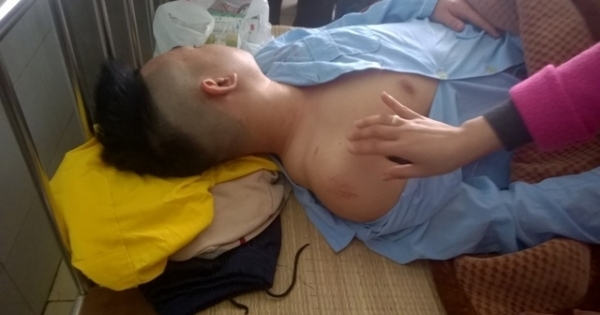 Thanh Hóa: Bị công an đánh "hội đồng", thanh niên nhập viện cấp cứu