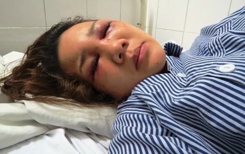Hải Dương: Thiếu úy cảnh sát trật tự bị tố “điên tình” đánh người yêu nhập viện