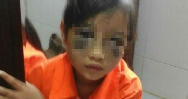 Lào Cai: Nghi án giáo viên tiểu học đánh tím mặt học sinh