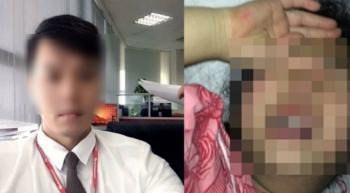 Ảnh kẻ xâm hại tình dục bé gái 8 tuổi ở Hà Nội bị phát tán khắp Facebook