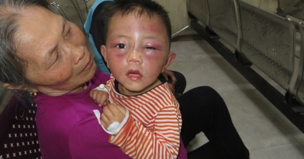 Nghệ An: Làm rõ việc cha dượng bị tố bạo hành con riêng vợ