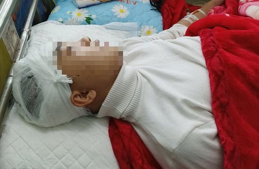 Thanh Hoá: Xem xét khởi tố vụ án nam sinh bị bạn cùng trường đập gậy sắt vào đầu