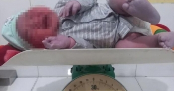 Bé trai chào đời nặng 6kg ở Hà Tĩnh