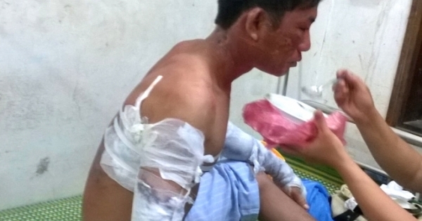 Nghệ An: 4 người nhập viện sau tiếng nổ lớn tại Nhà máy tinh bột sắn
