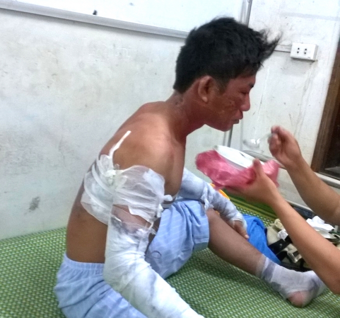 Anh Vi Khắc Nhớ bị thương nặng đang được điều trị tại BVĐK T&acirc;y Bắc Nghệ An.