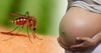 4 trường hợp cần nhanh chóng xét nghiệm virus Zika