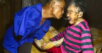 Dân mạng ứa nước mắt với chùm ảnh con trai cụt hai tay chăm sóc mẹ già suốt 48 năm