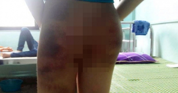 Hà Nội: Điều tra vụ học viên Trung tâm Đào tạo Vận động viên cấp cao bị đánh bầm khắp cơ thể