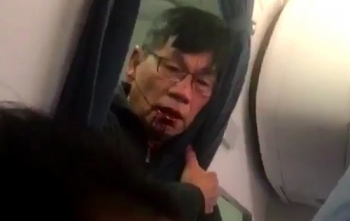 Hành khách gốc Việt gãy mũi sau khi bị lôi thô bạo khỏi máy bay