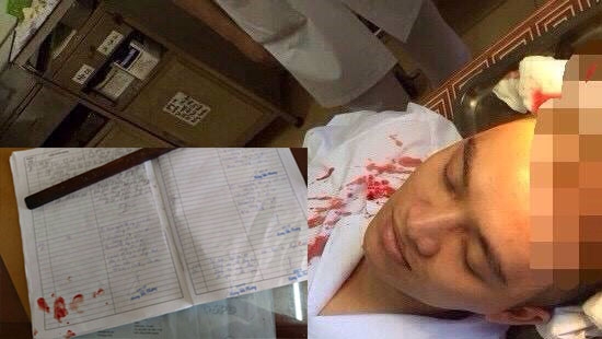 Hà Nội: Người nhà bệnh nhân hành hung một bác sĩ Phó Trưởng khoa