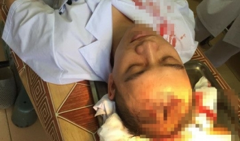 Bộ Y tế lên tiếng vụ bác sỹ Bệnh viện Đa khoa Thạch Thất bị hành hung