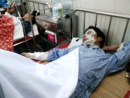 Bệnh nh&acirc;n vụ nổ l&ograve; luyện th&eacute;p đang điều trị tại bệnh viện Việt Tiệp.