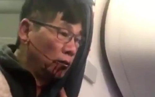&Ocirc;ng David Dao miệng đầy m&aacute;u tr&ecirc;n chuyến bay của United Airlines. Ảnh:&nbsp;Telegraph.