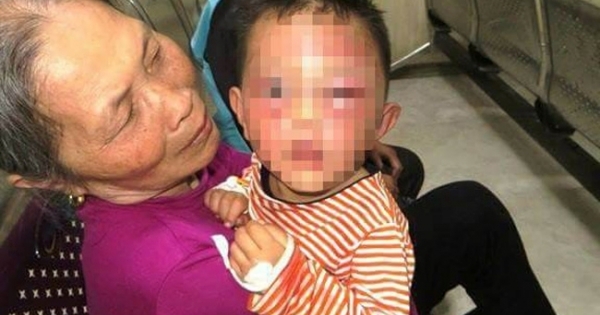 Nghệ An: Không khởi tố hình sự cha dượng tâm thần bạo hành con riêng của vợ