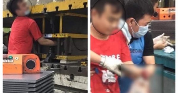 Công ty Seojin Việt Nam: Nam công nhân bị dập nát hai bàn tay