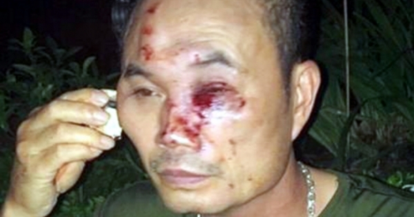 Hà Nội: Bảo vệ chung cư Linh Đàm bị nhóm côn đồ hành hung nhập viện