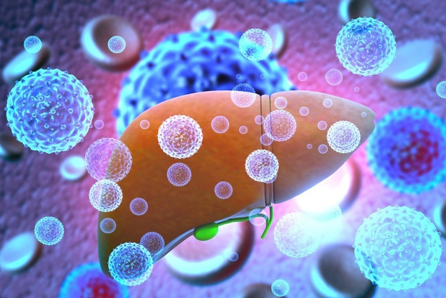 Hình minh họa 3D cho thấy lá gan bị nhiễm virus viêm gan. (Ảnh: Handout)