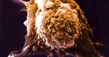 Mã hoá kháng nguyên - Đột phá mới trong nghiên cứu vắc xin ung thư