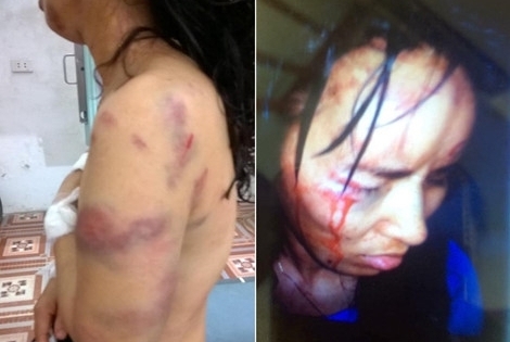 Vụ giáo viên tiểu học bị bạo hành đến "nát người": Khởi tố, bắt tạm giam người chồng