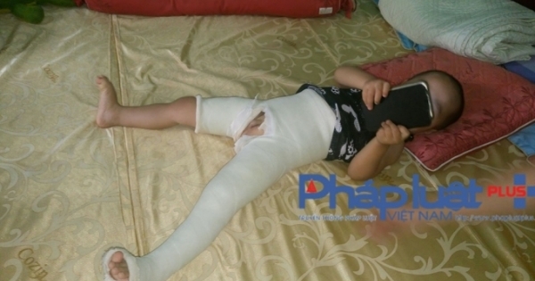 Tuyên Quang: Cô giáo mầm non đạp gãy xương đùi cháu nhỏ 3 tuổi?
