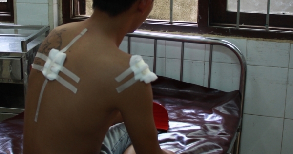ĐắK Lắk: Công an xã bắn 3 người vi phạm giao thông bị thương