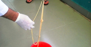 Quảng Nam: Lấy sán xơ mít dài khoảng 10 mét từ người bệnh