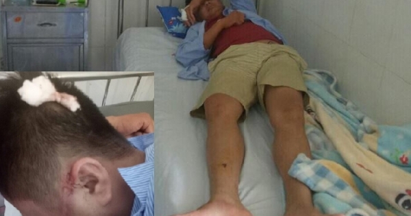Hưng Yên: Hành khách bị nhóm người lạ hành hung gây thương tích nặng