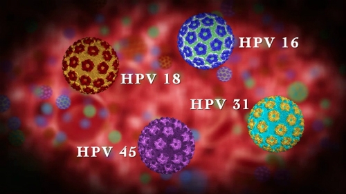 HPV l&agrave; bệnh l&acirc;y truyền qua đường t&igrave;nh dục rất phổ biến.&nbsp;