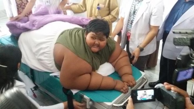 Cậu b&eacute; Arya Permana, người Indonesia, nặng tới 192 kg. Ảnh: Web.de