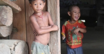 24,6% trẻ em Việt Nam suy sinh dưỡng thấp còi