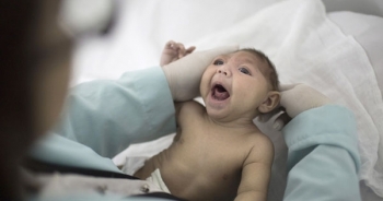 Châu Âu phát hiện em bé đầu tiên bị dị tật do nhiễm virus Zika
