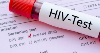 Làm gì khi có nguy cơ nhiễm HIV?