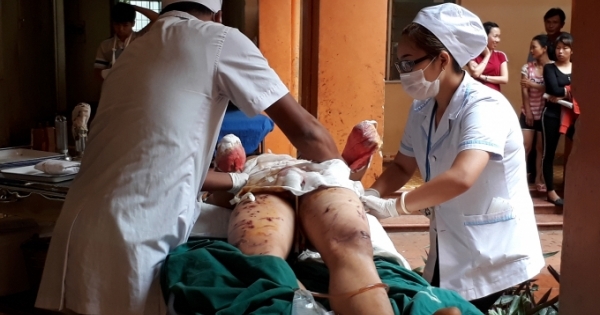 Krông Năng- Đắk Lắk: Phản ứng hóa chất phát nổ, một cháu bị cụt hai bàn tay