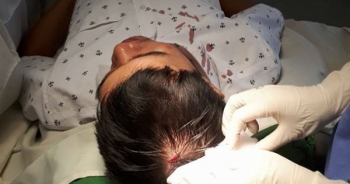 Bộ Y tế yêu cầu làm rõ vụ bác sỹ bị đánh ở Bắc Giang