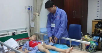 Sẽ điều trị miễn phí cho trẻ mắc sùi mào gà ở Hưng Yên