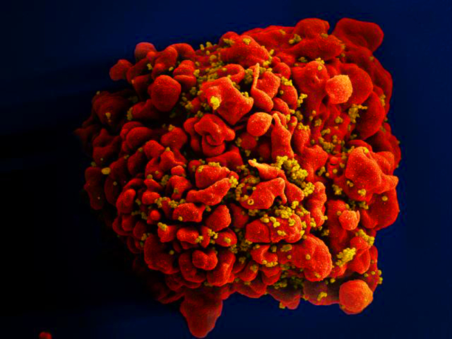 Em b&eacute; thứ ba tr&ecirc;n thế giới được chữa khỏi HIV