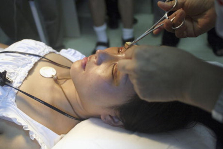 B&aacute;c sĩ tiến h&agrave;nh phẫu thuật thẩm mỹ cho một phụ nữ ở Bắc Kinh, Trung Quốc. Ảnh:&nbsp;Getty.